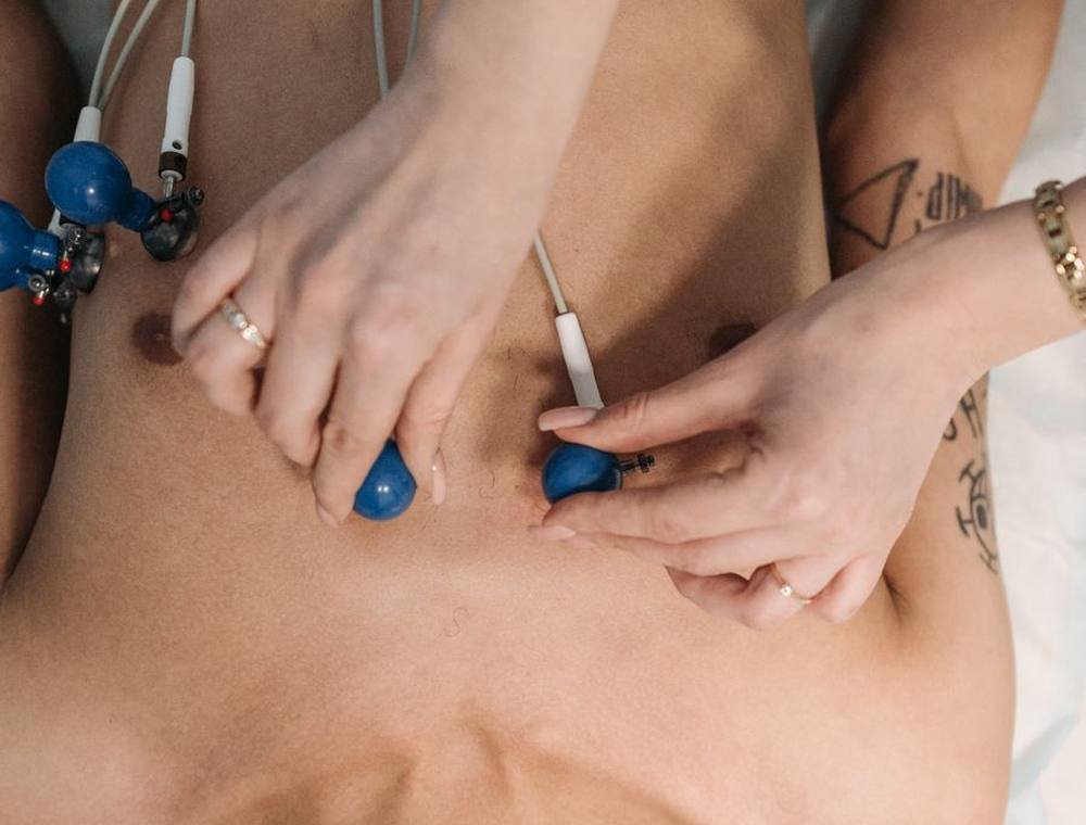 Dry Needling